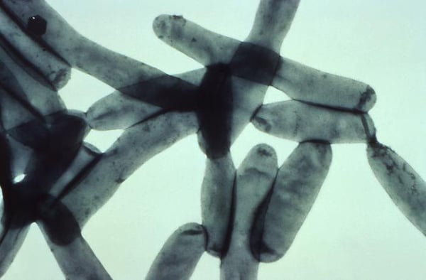 Legionella Bacteria