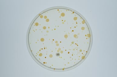 bacterial-colonies-emerged-on-agar-plate-2023-11-27-05-14-19-utc