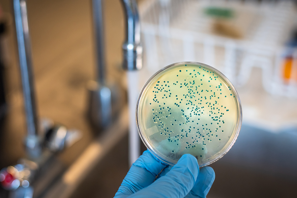 What is the Gold Standard Test for Legionnaires Disease?