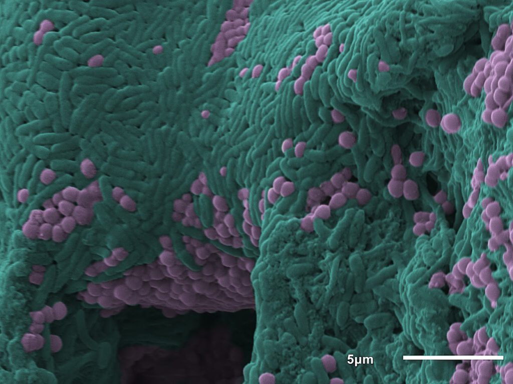 Close up of Biofilm